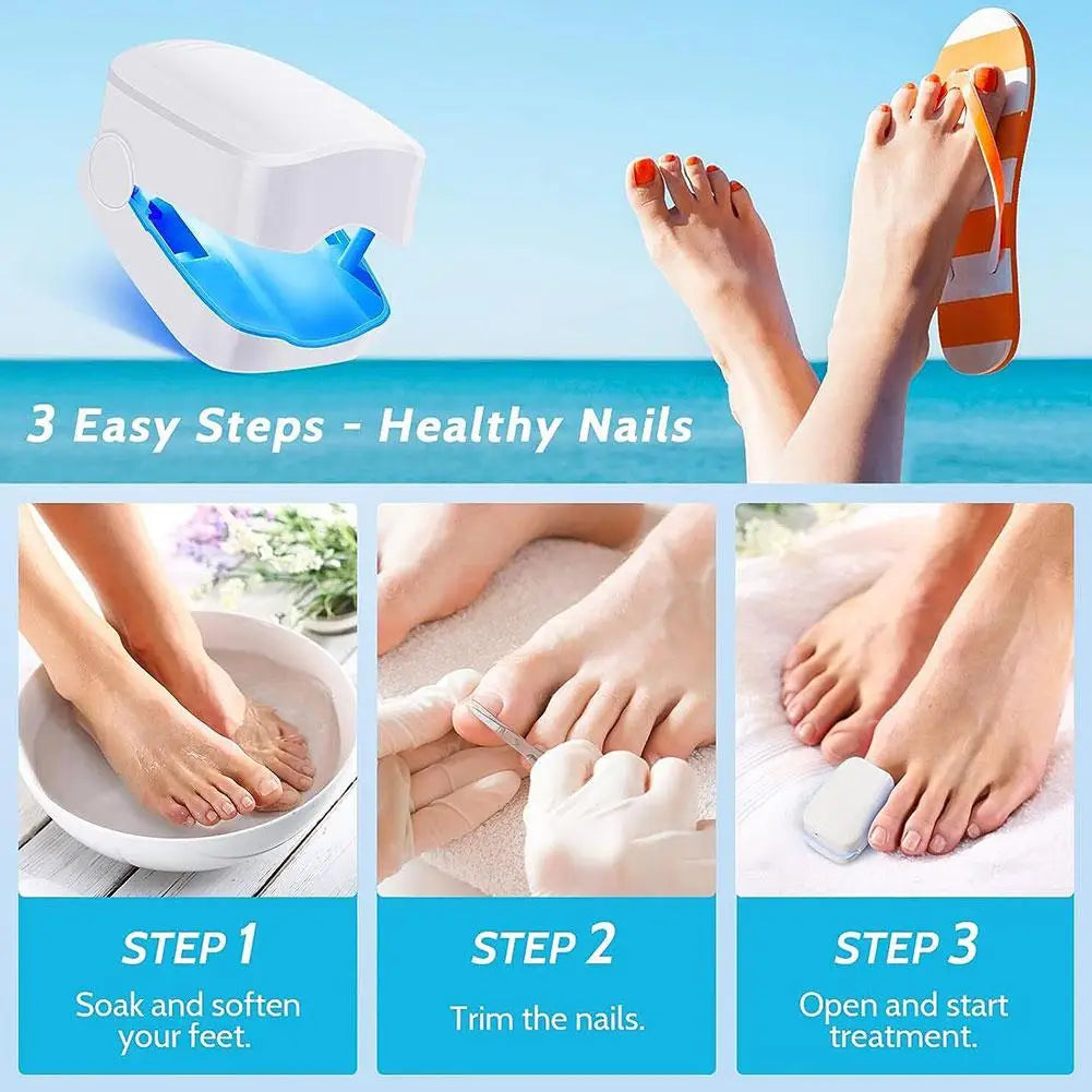 NO FUNGUS ™ O Número 1 contra fungos nas unhas!