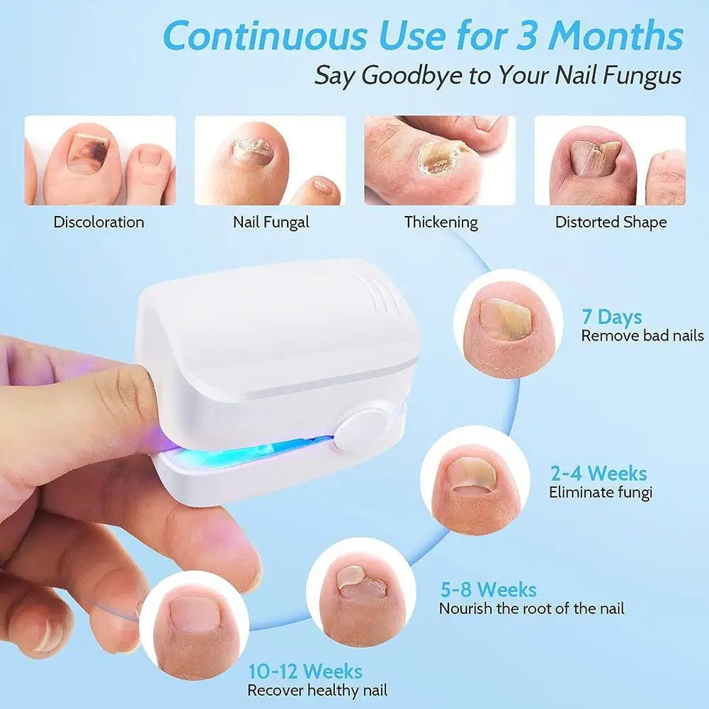 NO FUNGUS ™  O Número 1 contra fungos nas unhas!